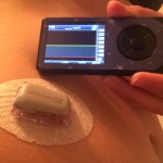 Dexcom 2